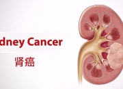 乐普生物科技：MRG003的注册性临床研究结果于2025年ASCO年会上公布