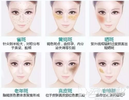 2025年美容祛斑仪行业前景展望及未来趋势预测_人保车险   品牌优势——快速了解燃油汽车车险,人保财险 