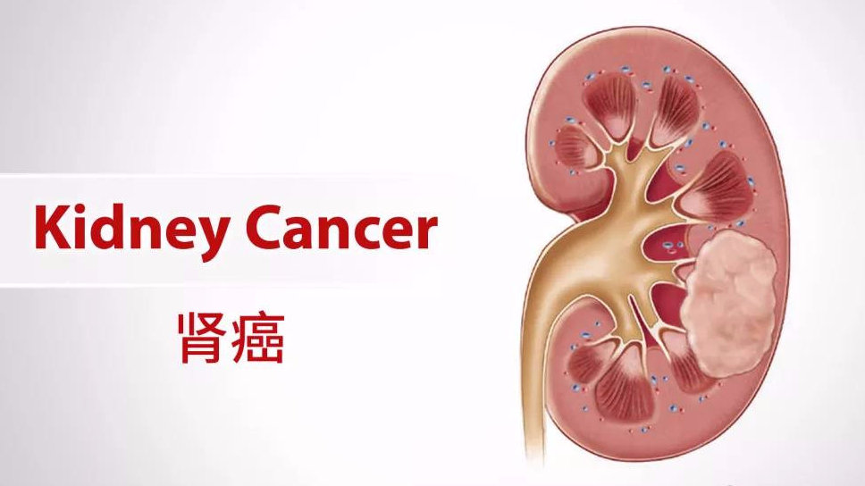 乐普生物科技：MRG003的注册性临床研究结果于2025年ASCO年会上公布